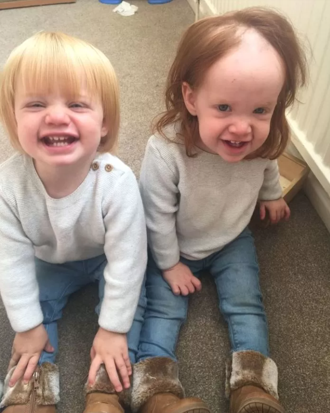 아기가 아빠를 흉내내다 대머리가 된 이유 (+사진 추가)