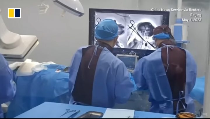 中연구팀, 원숭이 목에 칩 이식해 로봇팔 조종…영장류 뇌-기계 실험 성공한 이유