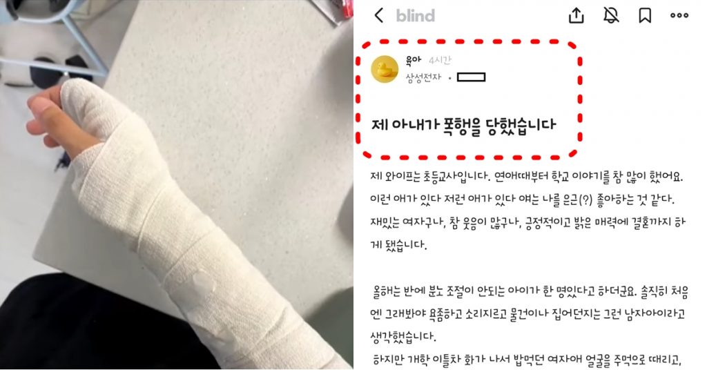서울 양천구 담임 교사 폭행 초6 부모, 뒤늦게 사과하며 내놓은 변명 수준 (+내용)